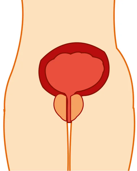 Bexiga urinária e glândula postada na tele pessoa — Vetor de Stock