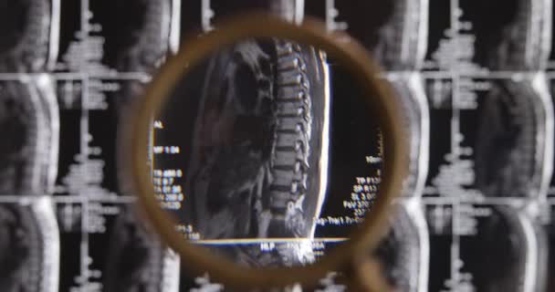 Mrt Lendenwirbelsäule Hintergrund Magnetresonanztomographie Arzt Untersucht Mrt Der Lendenwirbelsäule Mit — Stockvideo