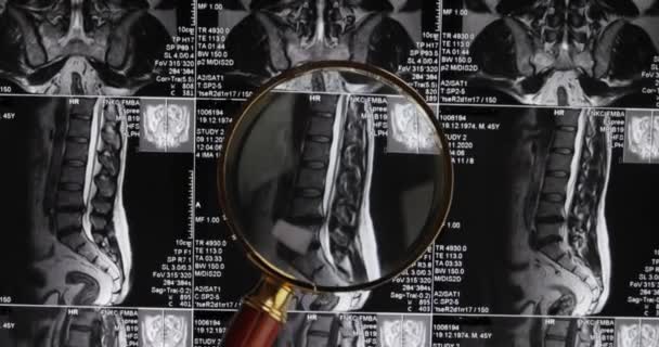 Mri Bederní Páteř Pozadí Magnetická Rezonance Tomografie Lékař Vyšetřuje Mri — Stock video