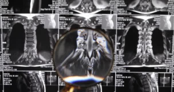 Irm Fond Lombaire Tomographie Par Résonance Magnétique Médecin Examine Irm — Video