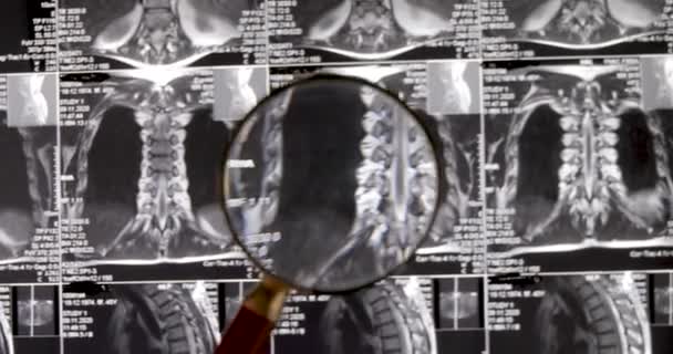 Resonancia Magnética Lumbar Tomografía Por Resonancia Magnética Médico Examina Resonancia — Vídeos de Stock