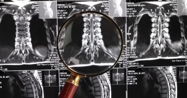 Mri腰椎背景磁気共鳴断層撮影 先生は腰椎のMriを脊椎と神経のピンで調べます — ストック動画