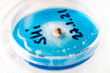 Petri kabı mikolojistinin laboratuvarında mantar miselyumu.