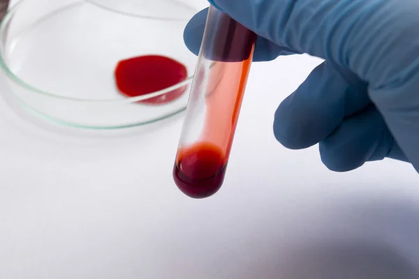 Tubos de sangue como o exame de sangue — Fotografia de Stock