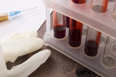 Tubes of blood as the blood test clipart