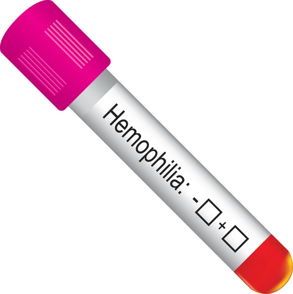 Recipiente Teste Hemofelia Padrão Marcado Positivo Negativo — Vetor de Stock