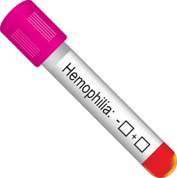 Contenedor Prueba Hemofelia Estándar Marcado Positivo Negativo — Archivo Imágenes Vectoriales