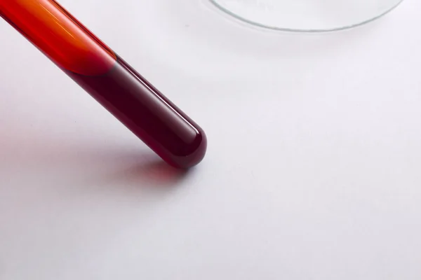 Tubes of blood as the blood test — Stock Photo, Image