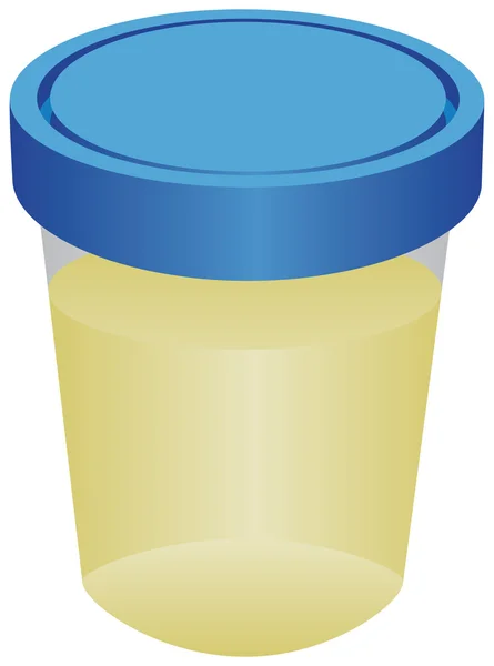 Behållare med urin för analys — Stock vektor