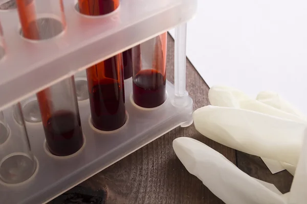 Tubes of blood as the blood test — Stock Photo, Image