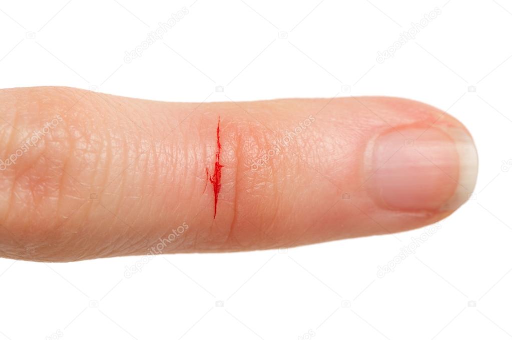 Cut Finger with Blood