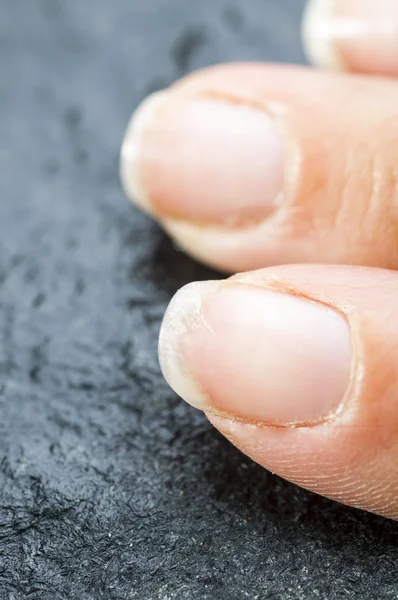 Beschadigde broze nagels — Stockfoto