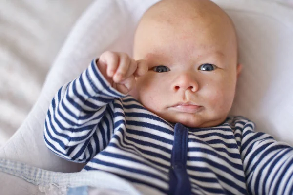 繭に赤ん坊のにきび発疹がある新生児 — ストック写真