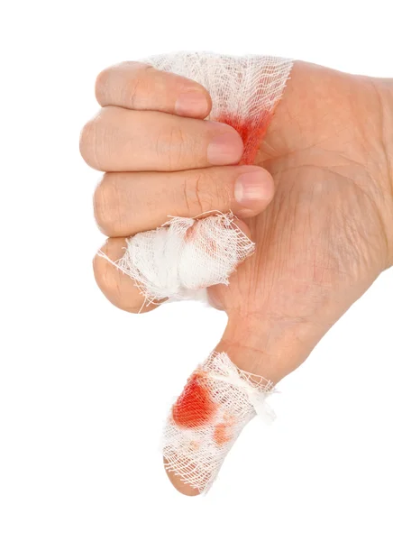 Polegar da mão com sangue e bandagem — Fotografia de Stock