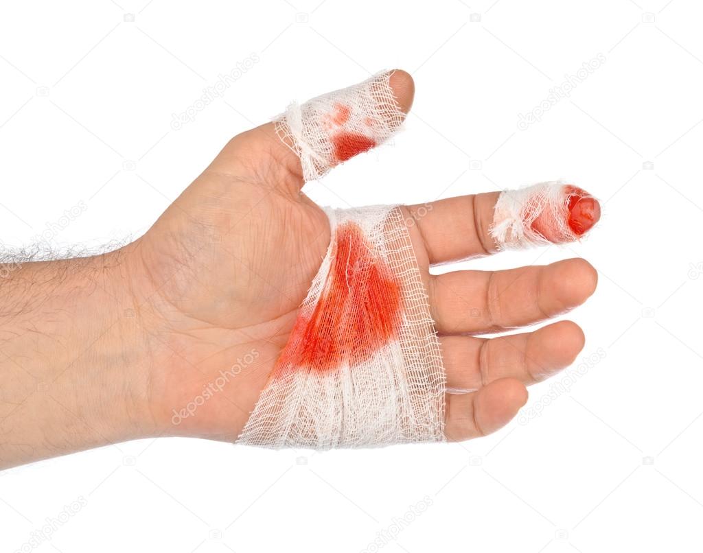 Hand With Blood And Bandage Stock Photo Image By C Violin