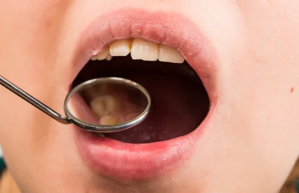 Tratamiento dental en el dentista —  Fotos de Stock