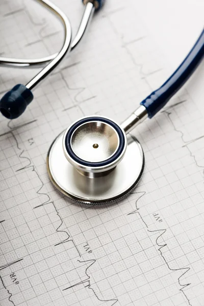 Stethoscope on cardiogram — Stock Photo, Image