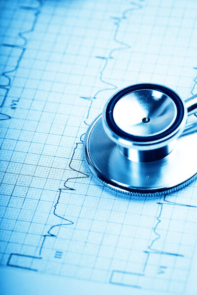 Stethoscope on cardiogram in blue colors