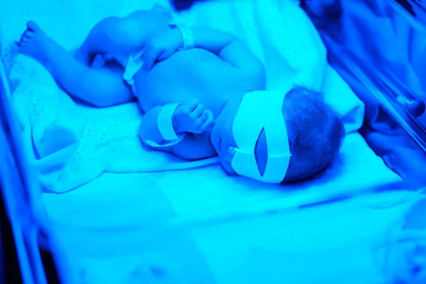 Neonato sotto la luce UV blu — Foto Stock