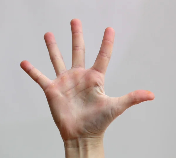 Pięć palców — Zdjęcie stockowe