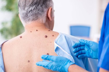 Yaşlı adam genç erkek doktor dermatoloğu ziyaret ediyor.