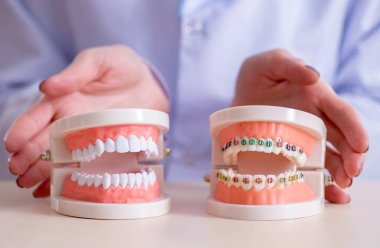 Diş hekimi, diş modeli üzerinde çalışıyor.