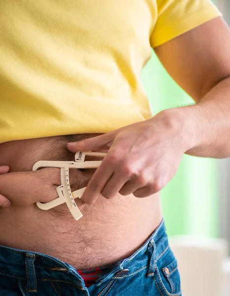 Anak muda mengukur lemak tubuh dengan kaliper — Stok Foto