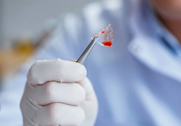 Jeune médecin travaillant sur un test sanguin dans un hôpital de laboratoire — Photo