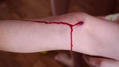 Erkek çocuk diz yaraya temizler 