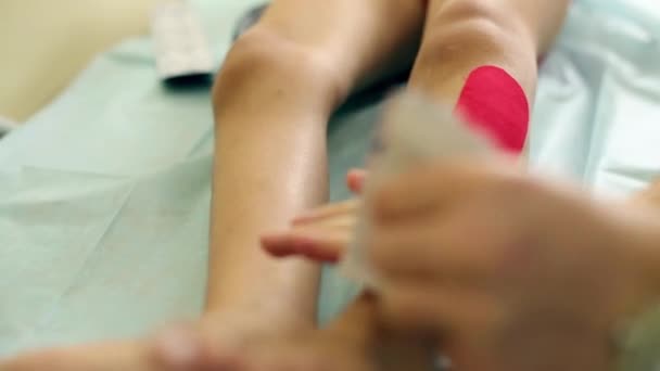 Hände des Arztes legen rotes Fixierband auf das Kinderbein — Stockvideo