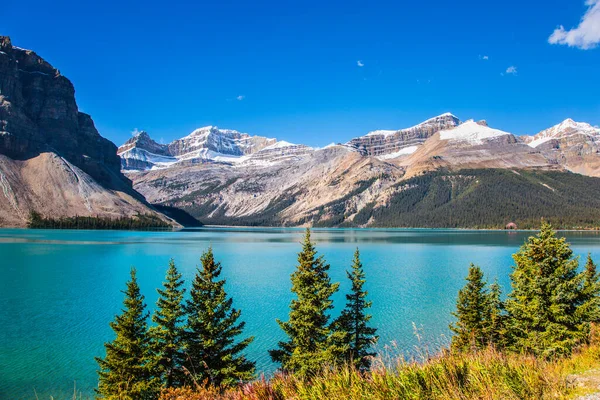 Lago Glaciale Con Acqua Limpida Azzurra Lago Bow Alberta Montagne — Foto Stock