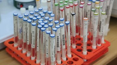 Reaktifler belirli alerjenlere tüplerini.