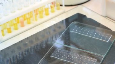 Mancini göre Radyal immunodiffusion tarafından kan serum immünglobulin kantitatif tayin.