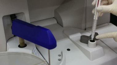 En iyi anti ve test çözümleri kullanarak gelişmiş otoimmünite sağlar