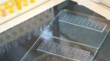 Mancini göre Radyal immunodiffusion tarafından kan serum immünglobulin kantitatif tayin.