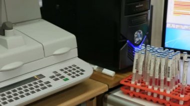 En iyi anti ve test çözümleri kullanarak gelişmiş otoimmünite sağlar