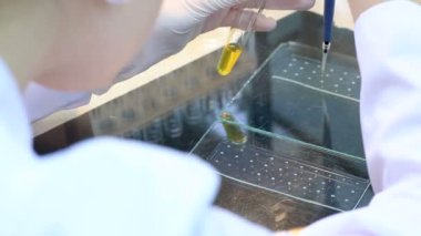 Mancini göre Radyal immunodiffusion tarafından kan serum immünglobulin kantitatif tayin.