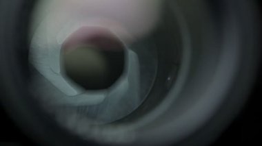 Lens operasyonu