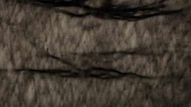 Plastik yanık. Yakın çekim.