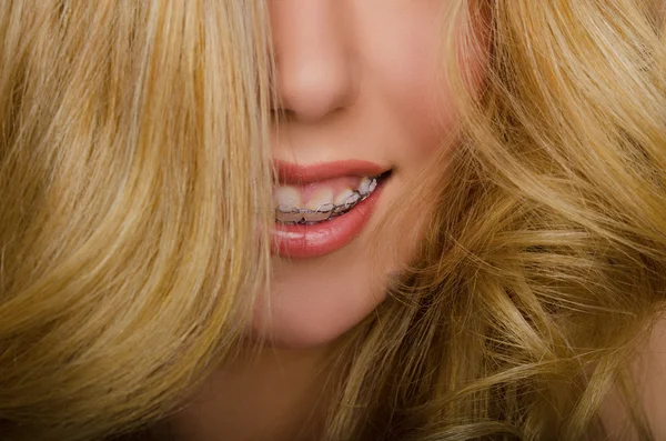 Face of beautiful woman with long hair and braces — Stock Photo, Image