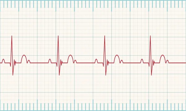 Сердцебиение — стоковый вектор