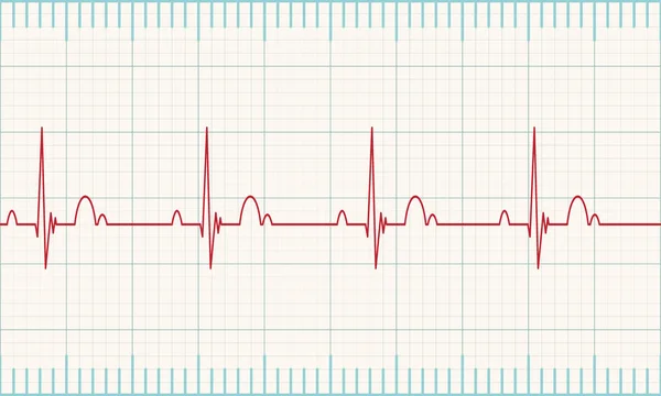 Heartbeat rate — Stock Vector