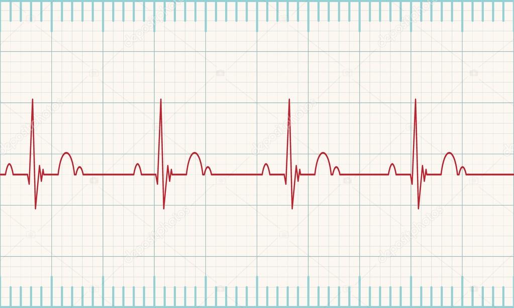 Heartbeat rate