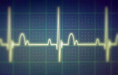 EKG - Ekg monitör