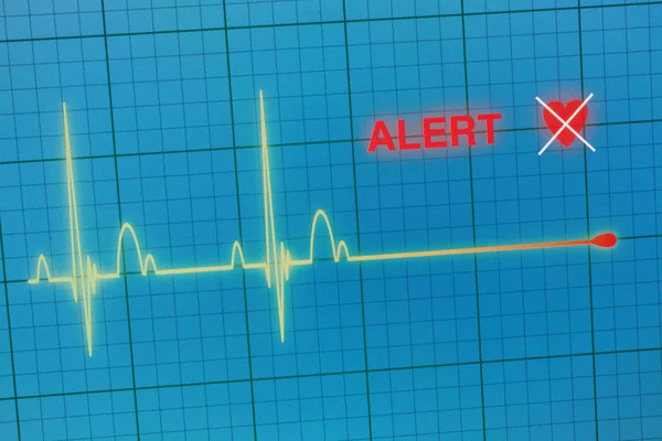 Hart klopt cardiogram op de monitor. — Stockfoto