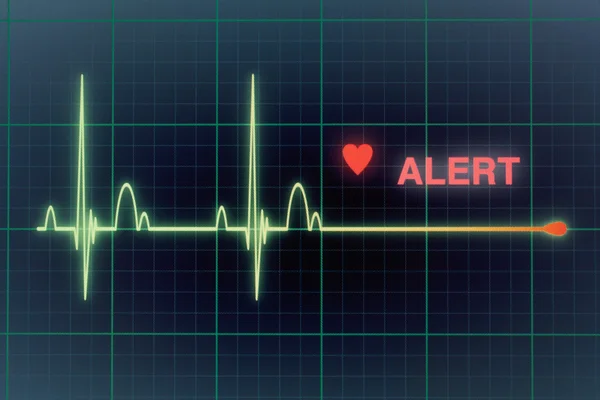 Heart beats cardiogram on the monitor. — Stock Photo, Image