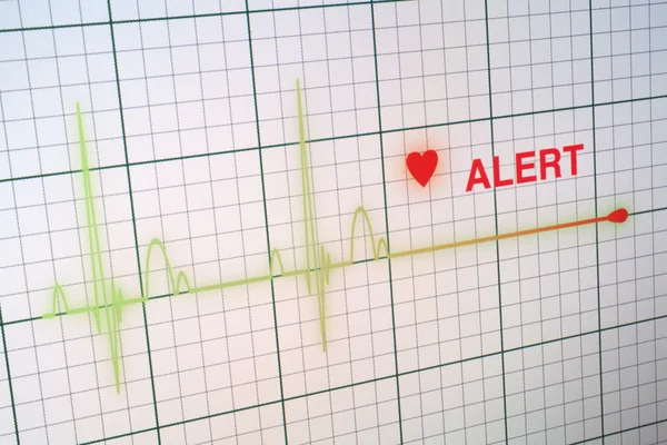 Hart klopt cardiogram op de monitor. — Stockfoto