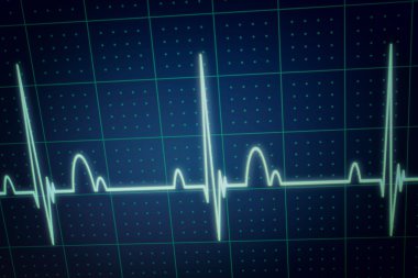 ECG - EKG monitor clipart