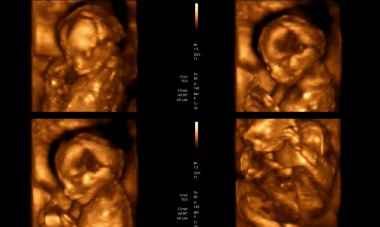 Medical images collage of 4D ultrasound during woman pregnancy s clipart