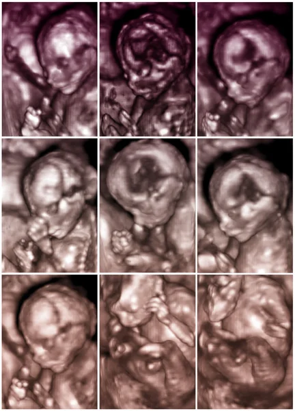 Series of nine 3D fetus ultrasonography pictures — Stock Photo, Image
